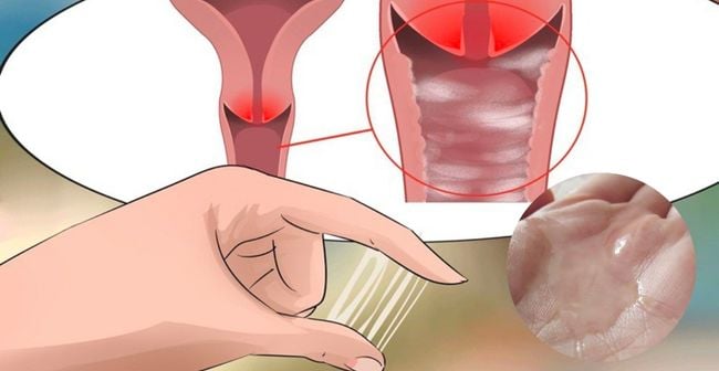 Rỉ ối, ra máu âm đạo hoặc thai giảm cử động là những dấu hiệu mẹ cần đi kiểm tra sớm 